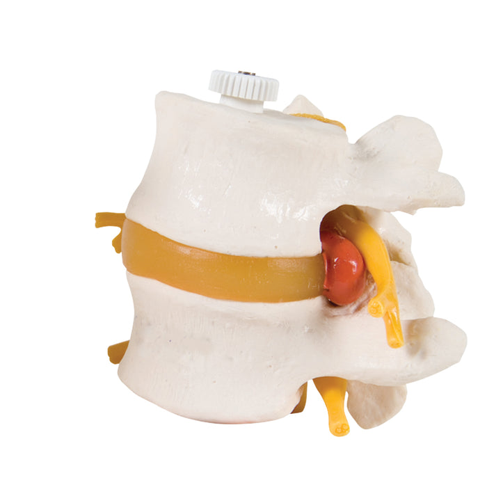 3B Scientific Anatomical Model - Lumbar Vertebrae, flexibly mounted