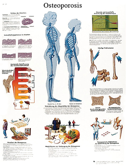 Anatomical Chart - Laminated