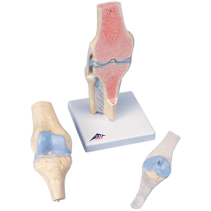 3B Scientific Anatomical Model - Sectional Knee Joint Model, 3 part